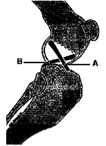 Intact ligaments